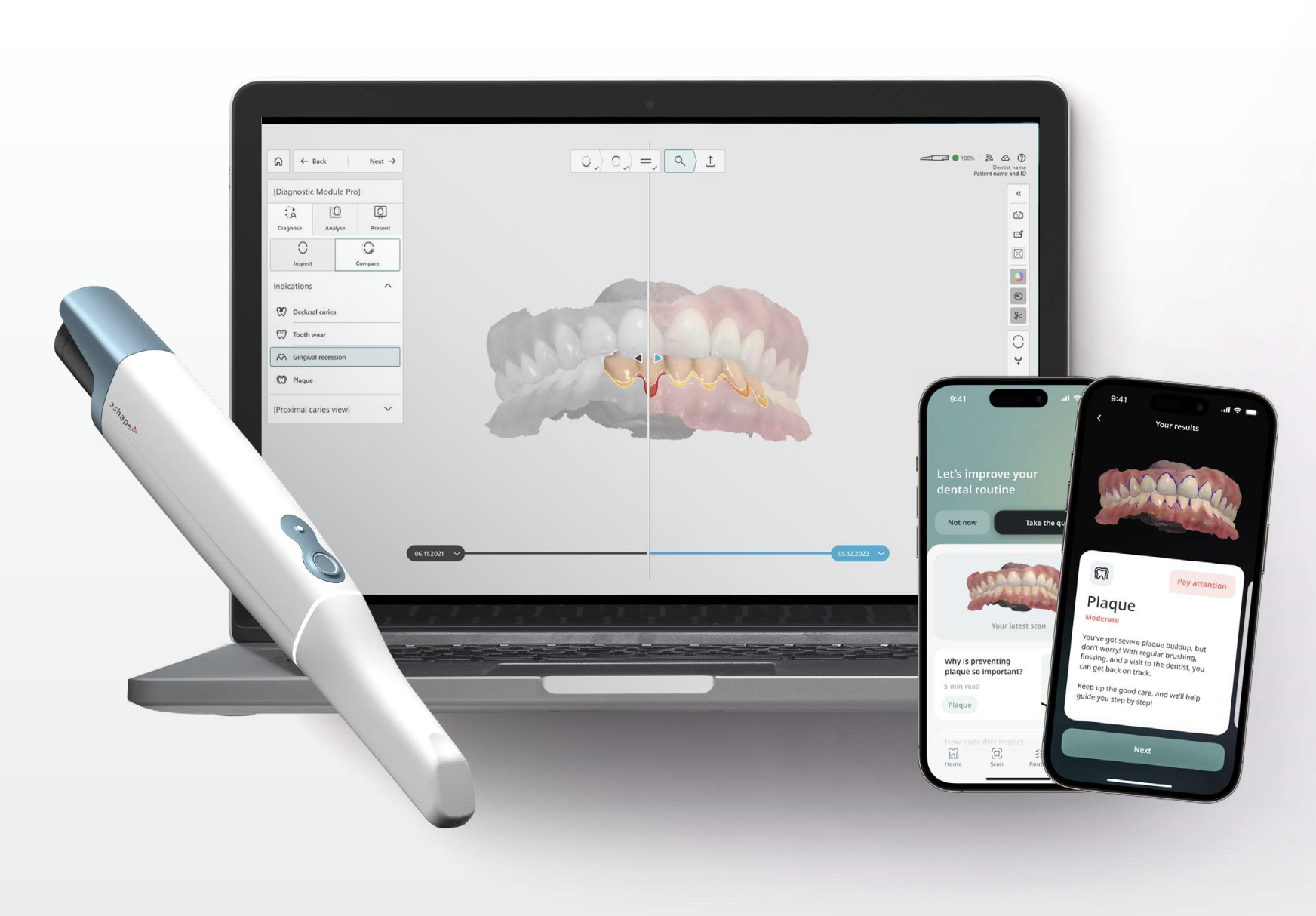 ESCANEO DENTAL CON IA